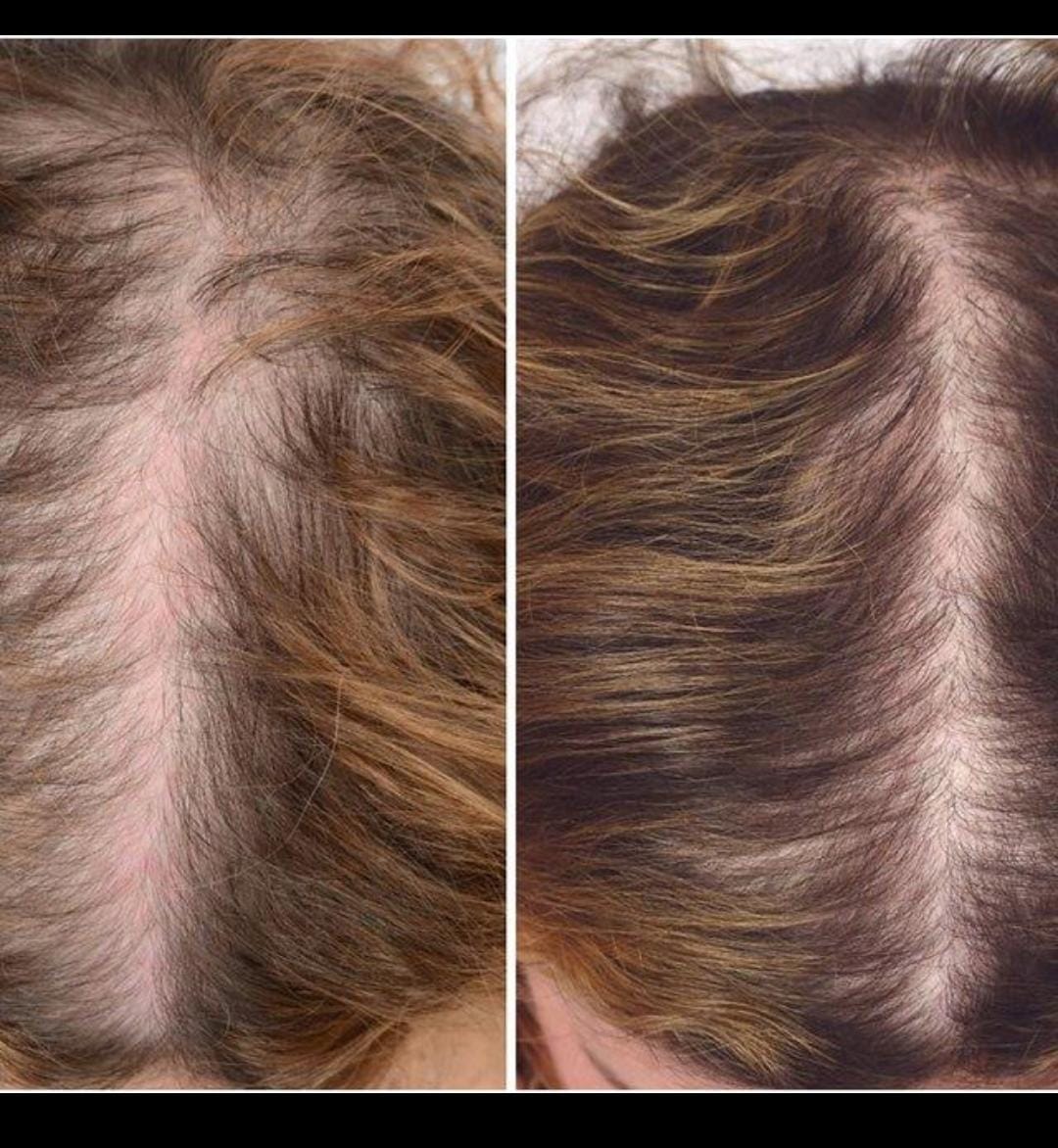 Hair — Before & After