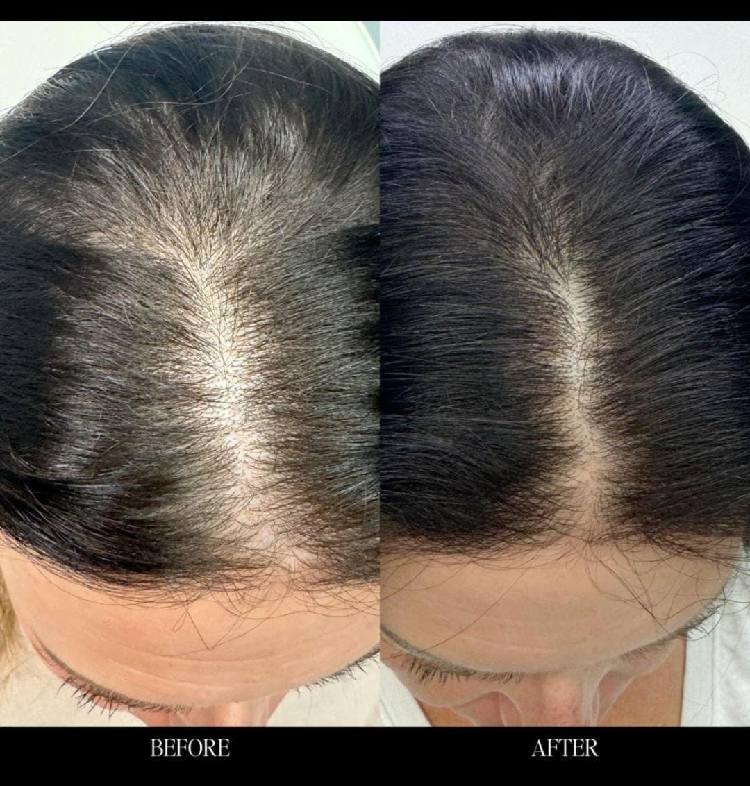 Hair — Before & After