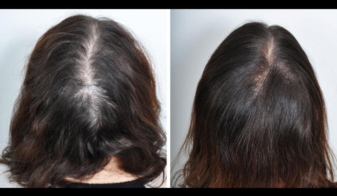 Hair — Before & After