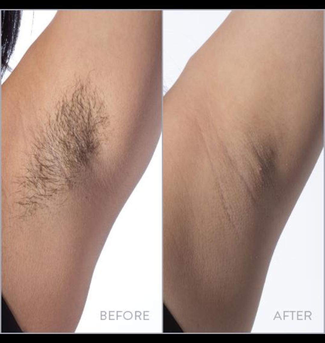 Skin — Before & After