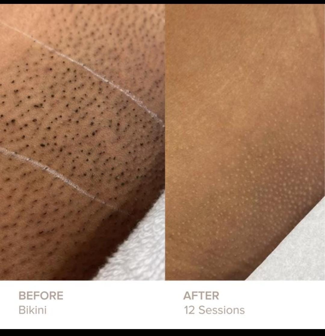 Skin — Before & After