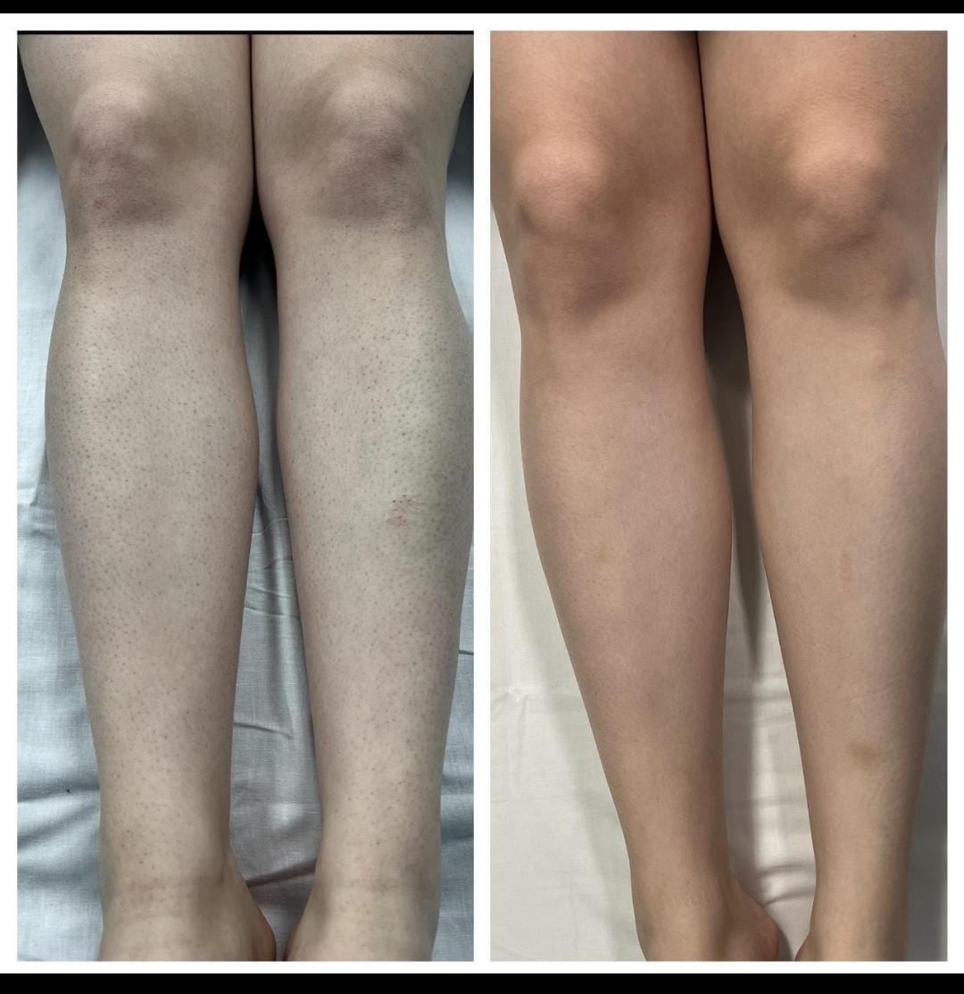 Skin — Before & After