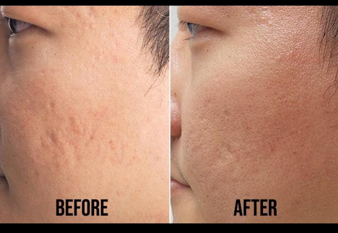 Skin — Before & After