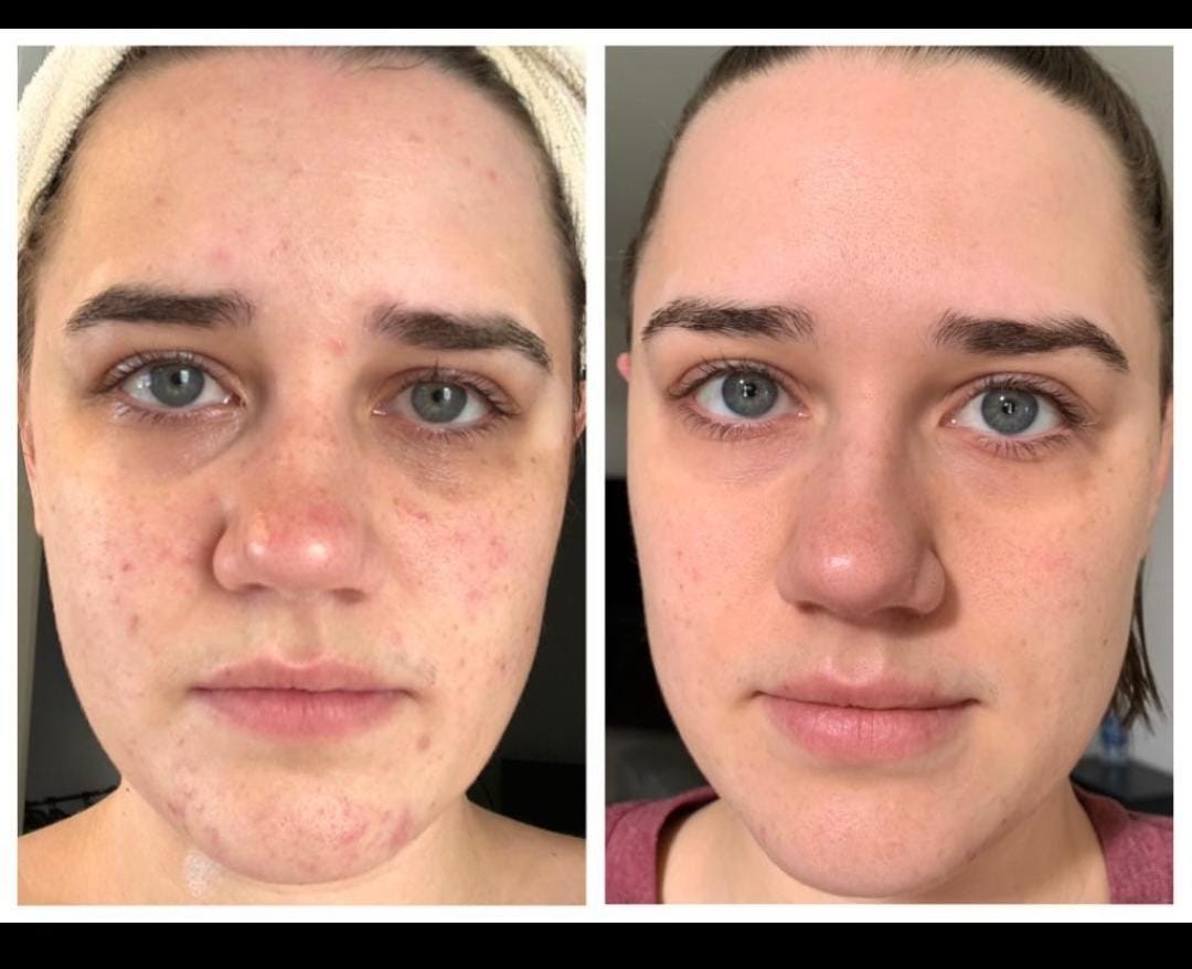 Skin — Before & After