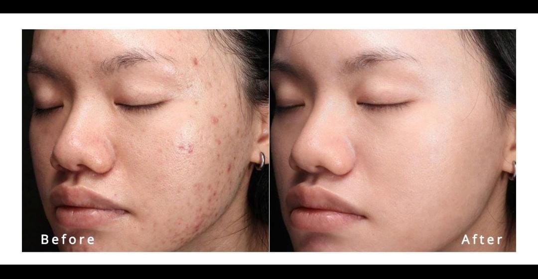 Skin — Before & After