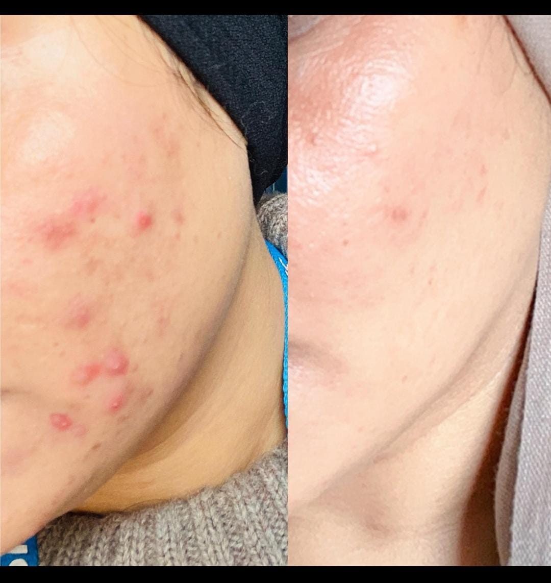 Skin — Before & After