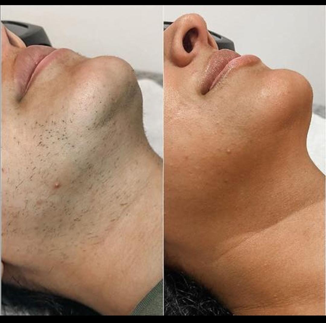 Skin — Before & After